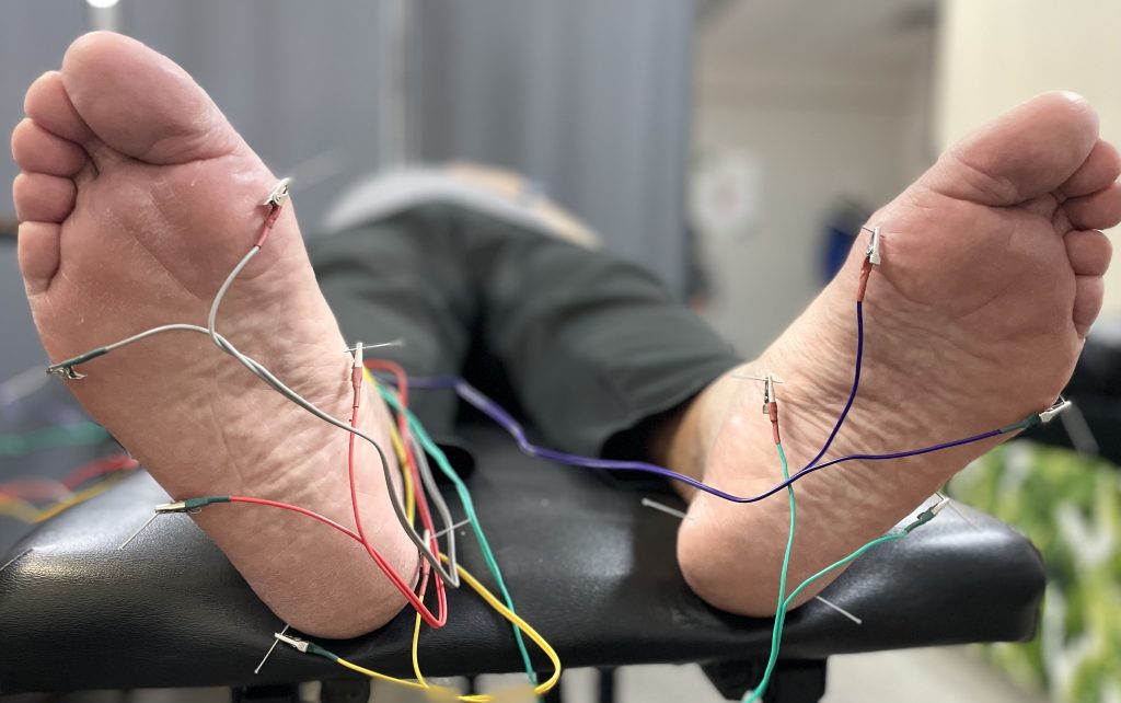 Dry needling in lubbock tx