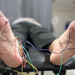 Needling Dry needling in lubbock tx